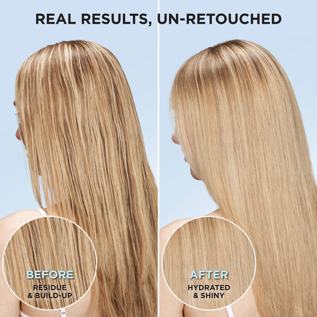 L'Oreal Paris Ever Pure Clarifying Shampoo with Vitamin C and Glycine for All Hair Types 6.8 fl oz