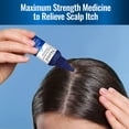 Nizoral Scalp Itch Relief Maximum Strength Hydrocortisone 1% Liquid 2 fl oz