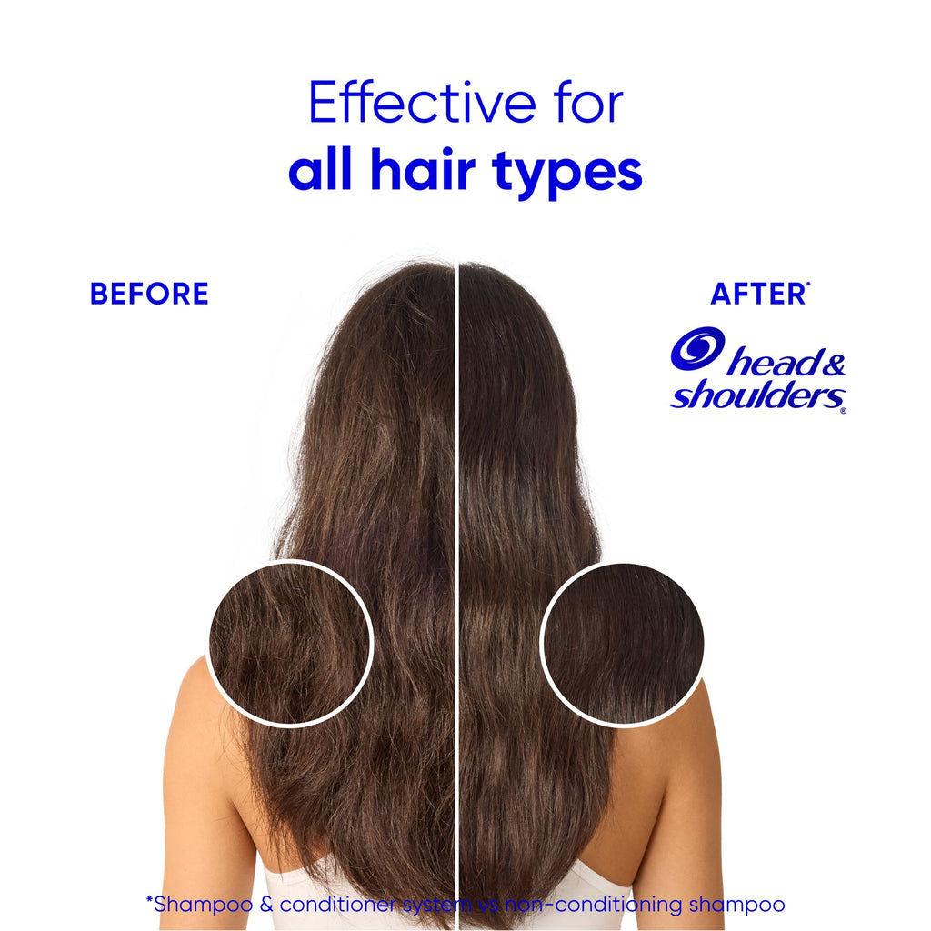Head & Shoulders 2in1 Anti-Dandruff Shampoo & Conditioner Coconut Hydrating 28.2 fl oz