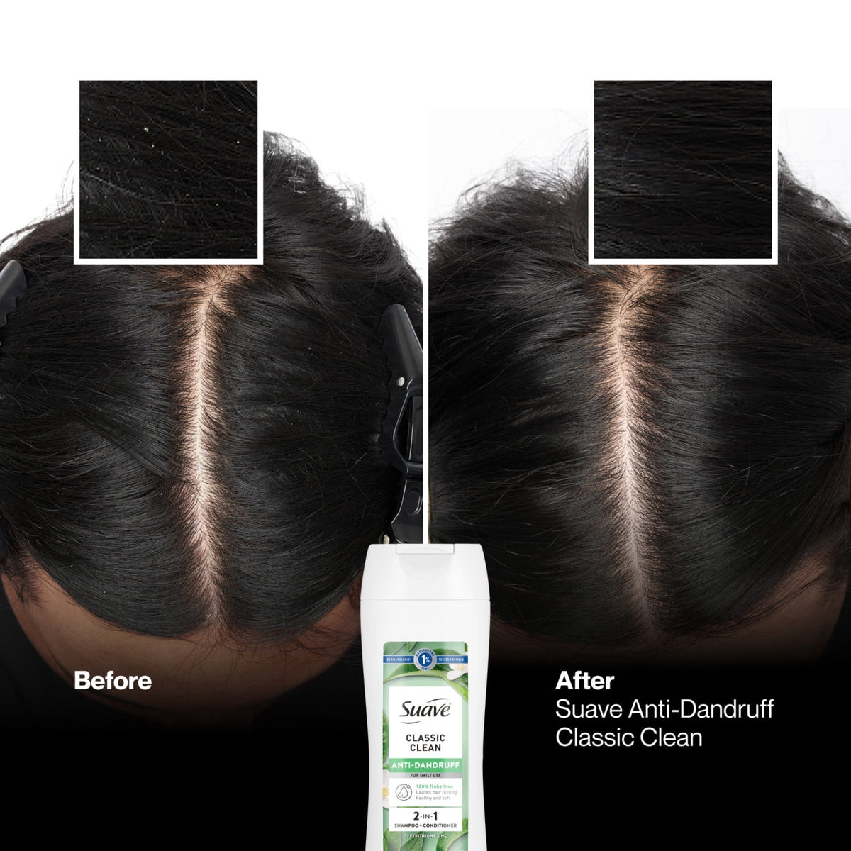 Suave Anti Dandruff 2-in-1 Shampoo & Conditioner for Women Classic Clean 12.6 fl oz