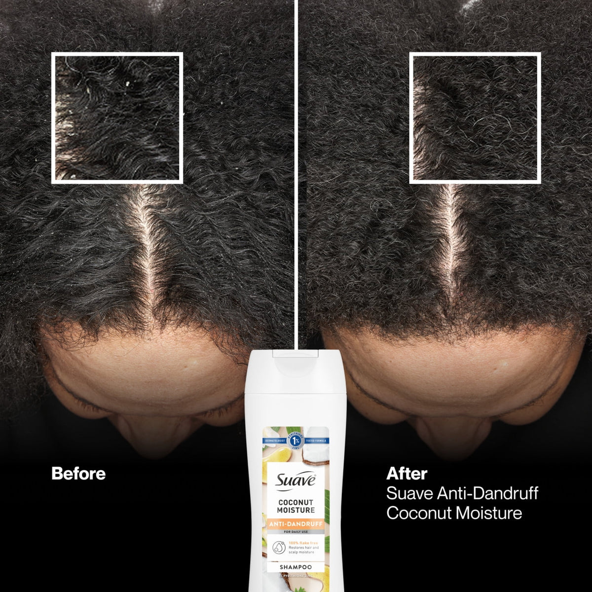 Suave Anti Dandruff Coconut Moisture Shampoo for Women 12.6 fl oz